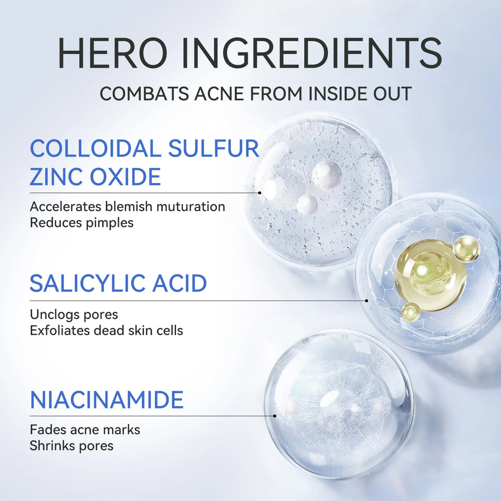 Acne Buster Plus - 1.8% Salicylic Acid Drying Lotion