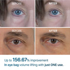 Dr. Melaxin – Eyephalt Eyebag Cream