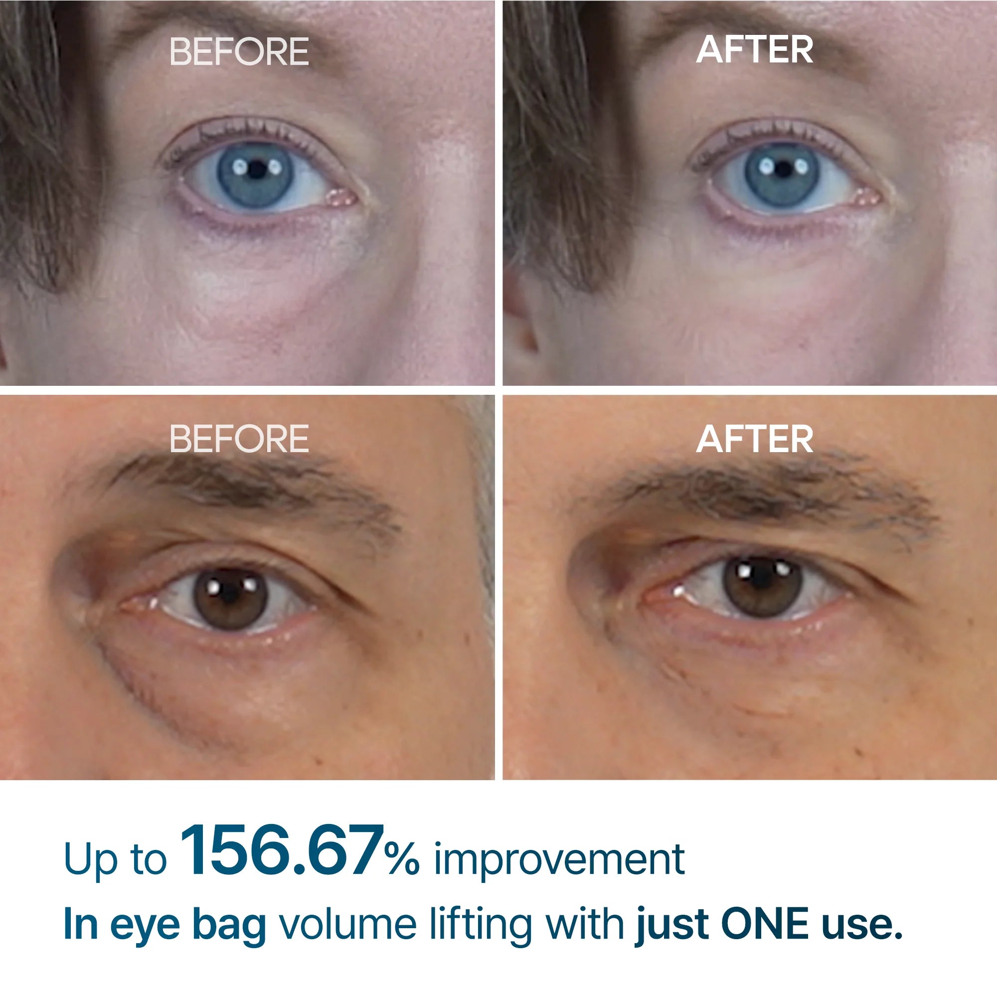 Dr. Melaxin – Eyephalt Eyebag Cream