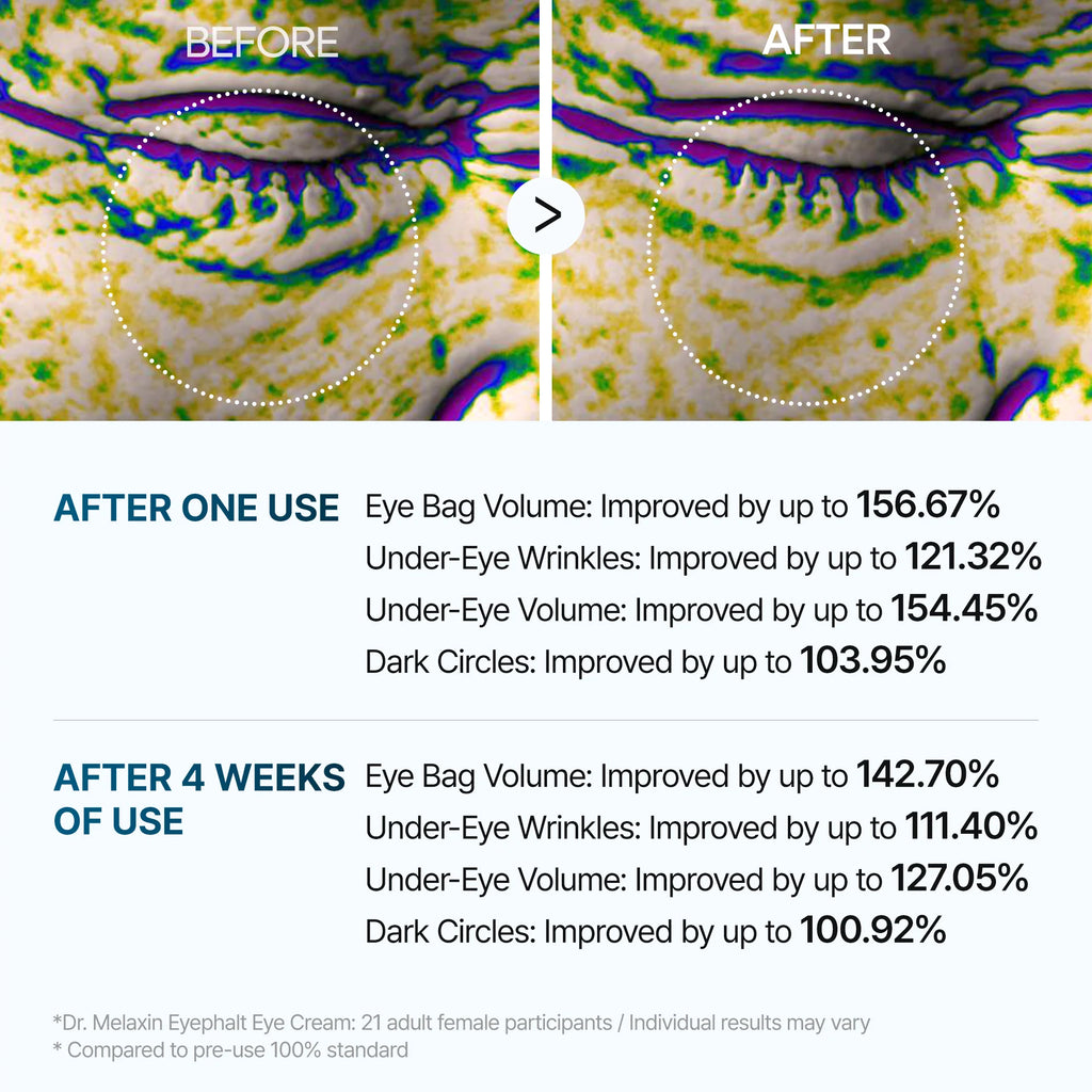 Dr. Melaxin – Eyephalt Eyebag Cream